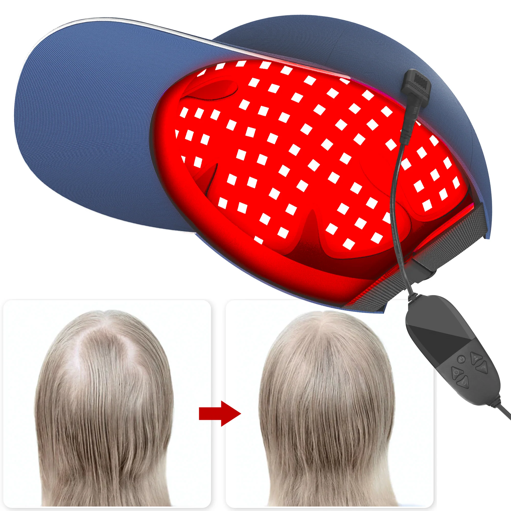 YOULUMI Red Light Therapy Cap For Hair Growth Hair Loss Treatments