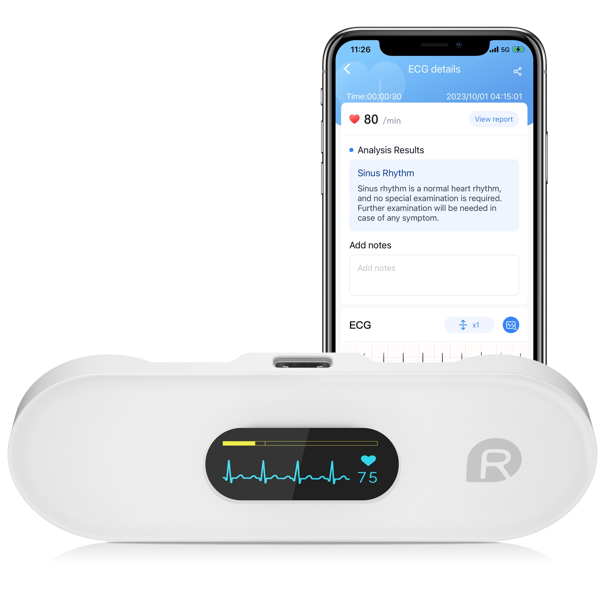 Checkme DuoEK S ECG Monitor